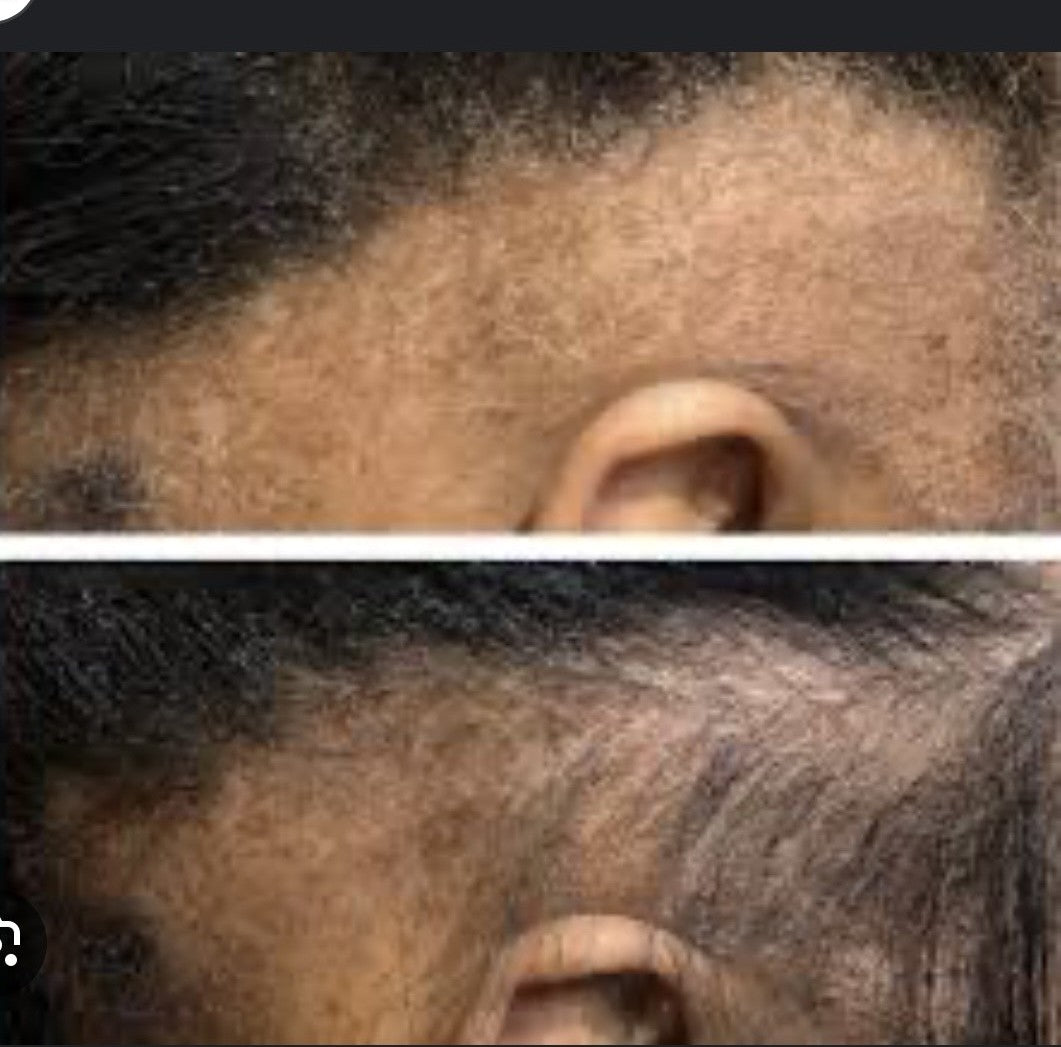 ALOPECIA Booster extra strength rosemary and fenugreek herbal hair growth oil
